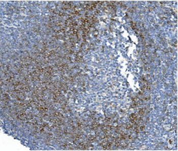 IHC staining of FFPE human tonsil with CD79b antibody. HIER: boil tissue sections in pH8 EDTA for 20 min and allow to cool before testing.