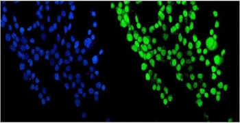 Immunofluorescent staining of FFPE human A431 cells with NUP214 antibody (green) and DAPI nuclear stain (blue). HIER: steam section in pH6 citrate buffer for 20 min.
