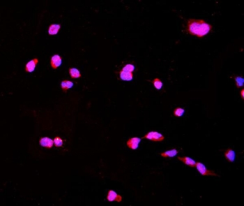 Immunofluorescent staining of FFPE mouse HEPA1-6 cells with CTHRC1 antibody (red) and DAPI nuclear stain (blue). HIER: steam section in pH6 citrate buffer for 20 min.