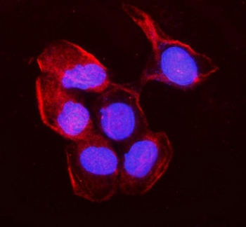Immunofluorescent staining of FFPE human A431 cells with MYH10 antibody (red) and DAPI nuclear stain (blue). HIER: steam section in pH6 citrate buffer for 20 min.