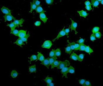 Immunofluorescent staining of FFPE mouse HEPA1-6 cells with AKAP12 antibody (green) and DAPI nuclear stain (blue). HIER: steam section in pH6 citrate buffer for 20 min.
