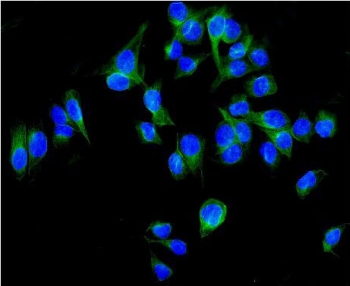 Immunofluorescent staining of FFPE human U-2 OS cells with ALDH1L1 antibody (green) and DAPI nuclear stain (blue). HIER: steam section in pH6 citrate buffer for 20 min.