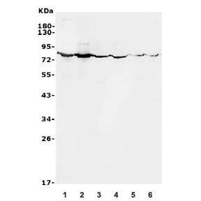 Western blot testing of 1) human HeLa, 2) human HEK293, 3) rat kidney, 4) rat RH35, 5) mouse kidney and 6) mouse HEPA1-6 lysate with ALPL antibody. Predicted molecular weight ~57 kDa, but can be observed at up to ~75 kDa due to glycosylation.