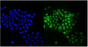 Immunofluorescent staining of FFPE human A431 cells with RAB9A antibody (green) and DAPI nuclear stain (blue). HIER: steam section in pH6 citrate buffer for 20 min.