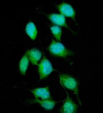 Immunofluorescent staining of FFPE human HeLa cells with XPC antibody (green) and DAPI nuclear stain (blue). HIER: steam section in pH6 citrate buffer for 20 min.
