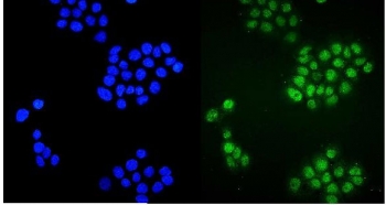 Immunofluorescent staining of FFPE human A431 cells with ZBTB16 antibody (green) and DAPI nuclear stain (blue). HIER: steam section in pH6 citrate buffer for 20 min.