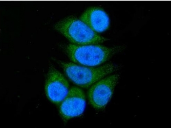 Immunofluorescent staining of FFPE human MCF7 cells with ACADSB antibody (green) and DAPI nuclear stain (blue). HIER: steam section in pH6 citrate buffer for 20 min.