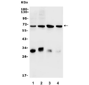 Western blot testing of rat 1) RH35, 2) C6 and mouse 3) HEPA1-6 and 4) Neuro-2a lysate with Arylsulfatase B antibody. Predicted molecular weight ~45 kDa but may be visualized at 60-70 kDa.