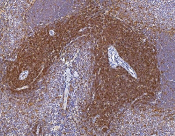 IHC staining of FFPE rat spleen with Cd2 antibody. HIER: boil tissue sections in pH8 EDTA for 20 min and allow to cool before testing.
