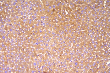 IHC staining of FFPE mouse liver with Cfh antibody. HIER: boil tissue sections in pH8 EDTA for 20 min and allow to cool before testing.
