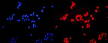 Immunofluorescent staining of FFPE human MCF7 cells with ETS Variant 5 antibody (red) and DAPI nuclear stain (blue). HIER: steam section in pH6 citrate buffer for 20 min.