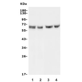 Western blot testing of 1) rat PC-12, 2) rat RH35, 3) mouse HEPA1-6 and 4) mouse SP2/0 lysate with Hyaluronidase 1 antibody. Expected molecular weight: 48-60 kDa.