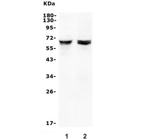 Western blot testing of human 1) A375 and 2) A431 cell lysate with JRK antibody. Predicted molecular weight ~65 kDa.