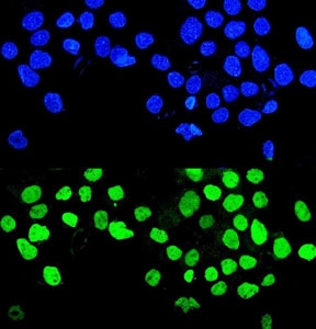 Immunofluorescent staining of FFPE human A431 cells with MMP28 antibody (green) and DAPI nuclear stain (blue). HIER: steam section in pH6 citrate buffer for 20 min.