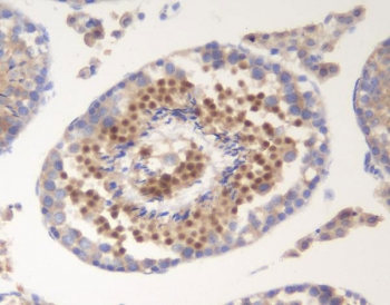 IHC staining of FFPE mouse testis with SOX6 antibody. HIER: boil tissue sections in pH8 EDTA for 20 min and allow to cool before testing.