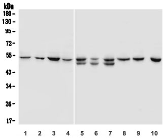 Western blot testing of human 1) A431, 2) HL-60, 3) K562, 4) ThP-1 and rat 5) spleen, 6) heart, 7) lung, 8) liver and mouse 9) spleen and 10) lung lysate with SOX11 antibody. Predicted molecular weight ~47 kDa.