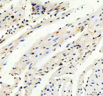 IHC staining of FFPE mouse heart tissue with TRIM63 antibody, HRP-secondary and DAB substrate. HIER: boil tissue sections in pH8 EDTA for 20 min and allow to cool before testing.