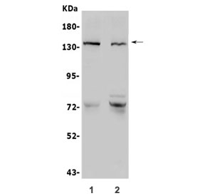 Western blot testing of human 1) LNCaP and 2) SGC-7901 lysate with CDH2 antibody. Predicted molecular weight ~100 kDa (unmodified), 125-140 kDa (modified).