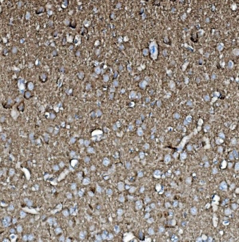 IHC staining of FFPE rat brain with GAP43 antibody. HIER: boil tissue sections in pH8 EDTA for 20 min and allow to cool before testing.