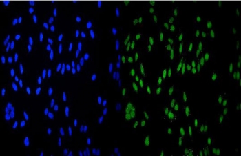 Immunofluorescent staining of FFPE human HeLa cells with HDAC9 antibody (green) and DAPI nuclear stain (blue). HIER: steam section in pH6 citrate buffer for 20 min.
