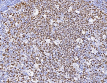 IHC staining of FFPE human tonsil with MCM6 antibody. HIER: boil tissue sections in pH8 EDTA for 20 min and allow to cool before testing.