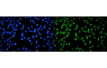 Immunofluorescent staining of FFPE human HeLa cells with RPA32 antibody (green) and DAPI nuclear stain (blue). HIER: steam section in pH6 citrate buffer for 20 min.