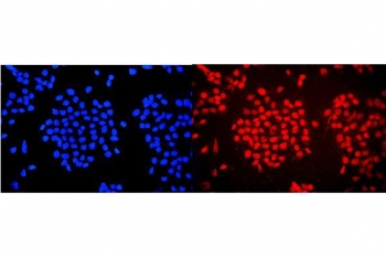 Immunofluorescent staining of FFPE human A431 cells with WAC antibody (red) and DAPI nuclear stain (blue). HIER: steam section in pH6 citrate buffer for 20 min.