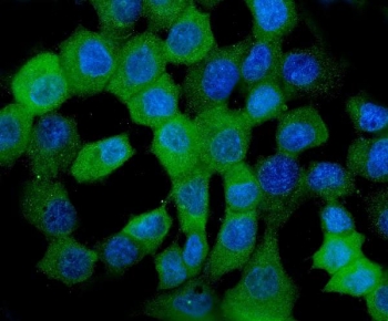 Immunofluorescent staining of FFPE human A431 cells with HSP22 antibody (green) and DAPI nuclear stain (blue). HIER: steam section in pH6 citrate buffer for 20 min.