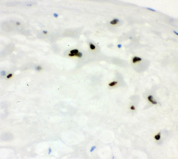 IHC staining of FFPE human placenta with CCNE1 antibody. HIER: boil tissue sections in pH8 EDTA for 20 min and allow to cool before testing.