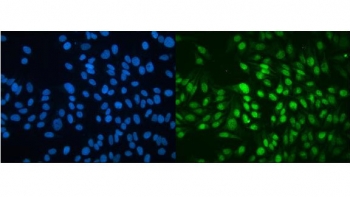 Immunofluorescent staining of FFPE human HeLa cells with MBD4 antibody (green) and DAPI nuclear stain (blue). HIER: steam section in pH6 citrate buffer for 20 min.