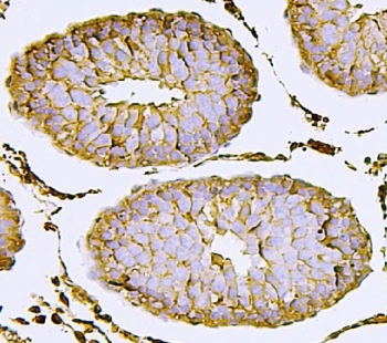 IHC staining of FFPE rat testis with Nectin 2 antibody. HIER: boil tissue sections in pH8 EDTA for 20 min and allow to cool before testing.