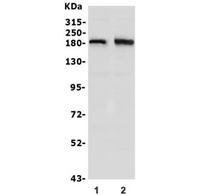 Western blot testing of human 1) SW620 and 2) U-87 MG lysate with hSET1 antibody. Predicted molecular weight ~186 kDa.