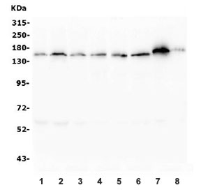 Western blot testing of human 1) COLO-320, 2) HEK293, 3) HeLa, 4) Jurkat, 5) HepG2, 6) Caco-2, 7) rat PC-12 and 8) mouse RAW264.7 lysate with ASXL1 antibody. Predicted molecular weight ~165 kDa.