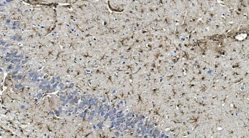 IHC staining of FFPE rat brain with GFAP antibody. HIER: boil tissue sections in pH8 EDTA for 20 min and allow to cool before testing.