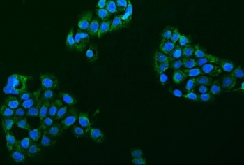 Immunofluorescent staining of FFPE human A431 cells with ASIC2 antibody (green) and DAPI nuclear stain (blue). HIER: steam section in pH6 citrate buffer for 20 min.