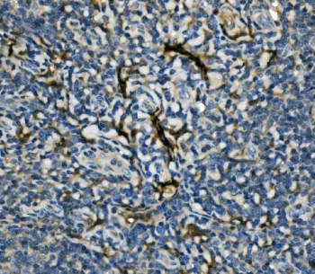 IHC staining of FFPE human tonsil with EIF4A1 antibody. HIER: boil tissue sections in pH8 EDTA for 20 min and allow to cool before testing.