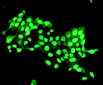 Immunofluorescent staining of FFPE human U-2 OS cells with DELE antibody. HIER: steam section in pH6 citrate buffer for 20 min.