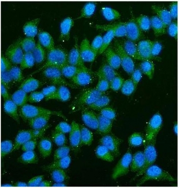 Immunofluorescent staining of FFPE human HeLa cells with CD59 antibody (green) and DAPI nuclear stain (blue). HIER: steam section in pH6 citrate buffer for 20 min.