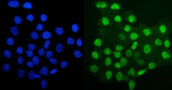 Immunofluorescent staining of FFPE human A431 cells with MCM4 antibody (green) and DAPI nuclear stain (blue). HIER: steam section in pH6 citrate buffer for 20 min.