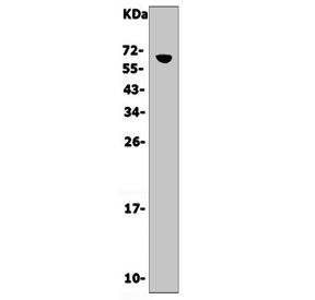 Western blot testing of mouse thymus lysate with Cd16 antibody. Expected molecular weight: 30-70 kDa depending on the level of glycosylation.
