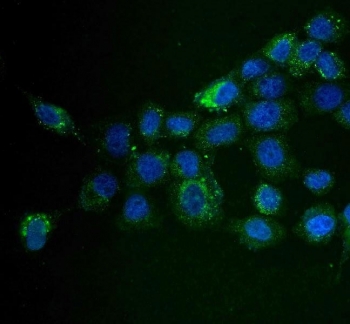 Immunofluorescent staining of FFPE human A431 cells with MAP4K5 antibody (green) and DAPI nuclear stain (blue). HIER: steam section in pH6 citrate buffer for 20 min.