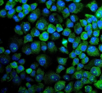 Immunofluorescent staining of FFPE human A431 cells with MAPK11 antibody (green) and DAPI nuclear stain (blue). HIER: steam section in pH6 citrate buffer for 20 min.