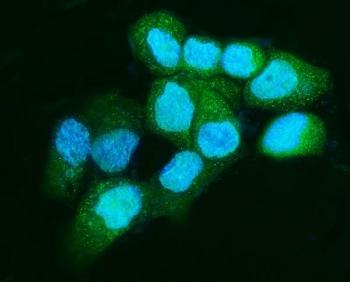 Immunofluorescent staining of FFPE human A431 cells with Apc5 antibody (green) and DAPI nuclear stain (blue). HIER: steam section in pH6 citrate buffer for 20 min.