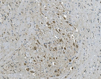 IHC staining of FFPE mouse brain tissue with GABRG2 antibody. HIER: boil tissue sections in pH8 EDTA for 20 min and allow to cool before testing.