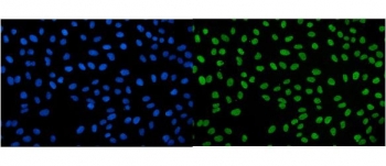 Immunofluorescent staining of FFPE human U-2 OS cells with IGF2-AS antibody (green) and DAPI nuclear stain (blue). HIER: steam section in pH6 citrate buffer for 20 min.