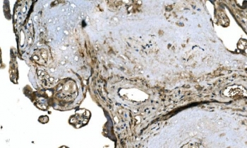 IHC staining of FFPE human placenta with OTULIN antibody. HIER: boil tissue sections in pH8 EDTA for 20 min and allow to cool before testing.