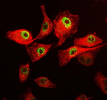 Immunofluorescent staining of FFPE human A549 cells with CDK12 antibody (green) and Beta Tubulin mAb (red). HIER: steam section in pH6 citrate buffer for 20 min.