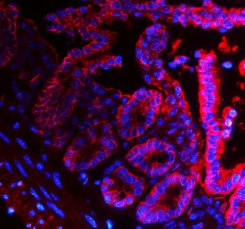Immunofluorescent staining of FFPE mouse intestine with Epcam antibody (red) and DAPI nuclear stain (blue). HIER: steam section in pH8 EDTA for 20 min.