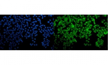 Immunofluorescent staining of FFPE human T-47D cells with HOXC10 antibody (green) and DAPI nuclear stain (blue). HIER: steam section in pH6 citrate buffer for 20 min.