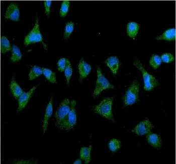 Immunofluorescent staining of FFPE human A549 cells with IL2RB antibody (green) and DAPI nuclear stain (blue). HIER: steam section in pH6 citrate buffer for 20 min.